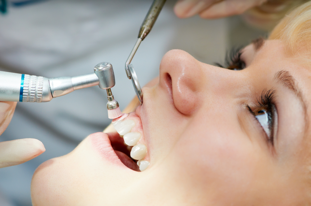 Dental Cleaning Consultation