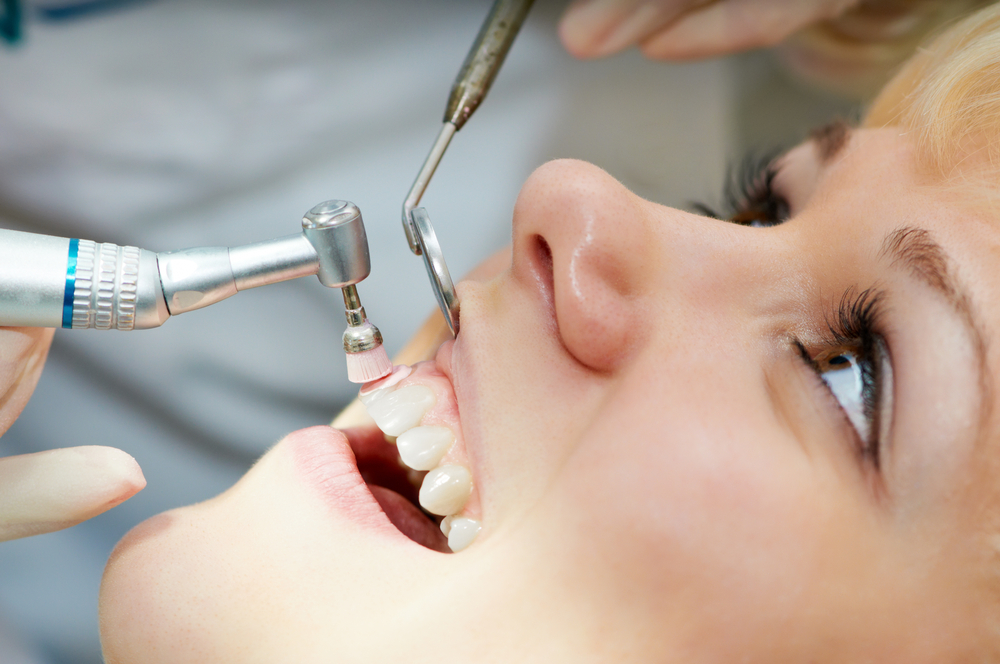 dentist teeth cleaning procedure